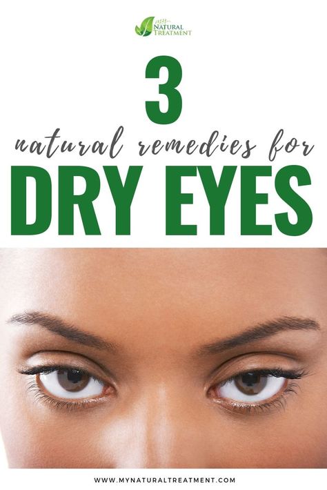 Dry Eye Remedies, Eye Health Remedies, Dry Eyelids, Dry Eyes Causes, Irritated Eye, Dry Eyes Relief, Dry Eye, Eye Sight Improvement, Eye Exercises