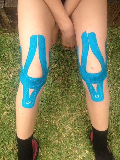 KT Tape Pro full knee support | Flickr - Photo Sharing! Kt Tape Knee, Knee Taping, Fitness Before After, K Tape, Kt Tape, Knee Pain Exercises, Kinesio Taping, Sports Tape, Kinesiology Taping