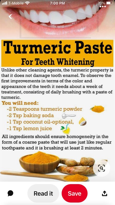 Natural Teeth Whitening Remedies, Turmeric Paste, Teeth Whitening Homemade, Teeth Whitening Remedies, Teeth Whitening Diy, Teeth Health, Home Health Remedies, Natural Teeth Whitening, Natural Teeth