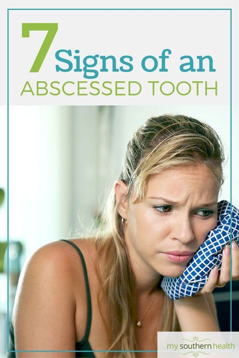 More than just a toothache -- know the 7 symptoms of an abscessed tooth. #mysouthernhealth #oralcare #absessedtooth #toothachetips Absessed Tooth, Abcessed Tooth, Tooth Pain Remedies, Abscess Tooth, Wisdom Teeth Pain, Tooth Pain Relief, Tooth Extraction Aftercare, Wisdom Teeth Funny, Impacted Tooth