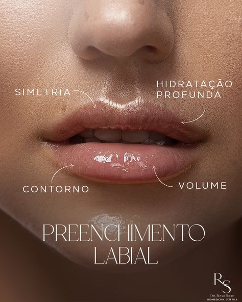 Realce sua beleza natural com um toque de glamour nos lábios. Agende uma avaliação e venha fazer o seu preenchimento! #beleza #estetica Waxing Salon, Aesthetic Clinic, Nail Design Inspiration, Beauty Clinic, Medical Design, Beauty Center, Medical Spa, Med Spa, Instagram Blog