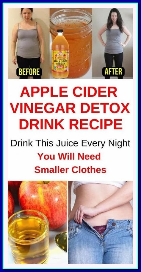 Board name Apple Cider Vinegar At Night, Food Cleanse, Apple Cider Detox, Apple Cider Vinegar Remedies, Apple Cider Vinegar Detox Drink, Detox Kur, Apple Cider Vinegar Detox, Body Detoxification, Apple Cider Vinegar Drink