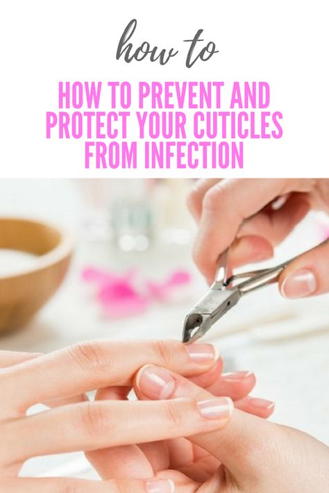 How to Prevent and Protect Your Cuticles From Infection Infected Cuticle, Nail Cuticle, The Signs, Home Remedies, Self Care, Nail Polish, Signs, Nails, Beauty