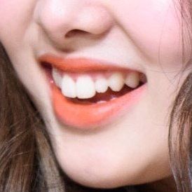 Cool Birthmarks, Perfect Teeth Aesthetic Korean, Teeth Claims For Dr, Bunny Teeth Aesthetic, Teeth Claim, Straight Teeth Subliminal, Smile Teeth Aesthetic, Bunny Teeth Smile, Beautiful Smile Teeth Aesthetic