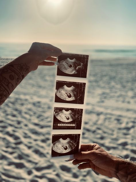 #ultrasound #pregnancy #momtobe #beach #dad #excited #peanut Beach Baby Announcement Pictures, Beach Announcement Photos, Sonogram Picture Ideas Beach, Fall Beach Pregnancy Announcement, Beach Announcement Baby, Lake Baby Announcement, Baby Beach Announcement, Beach Baby Announcement With Sibling, Ultrasound Photoshoot