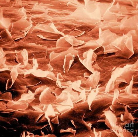 Human Cadaver, Scanning Electron Micrograph, Micro Photography, Microscopic Images, Medical Art, Close Up, Medical, Abstract Artwork, Natural Landmarks