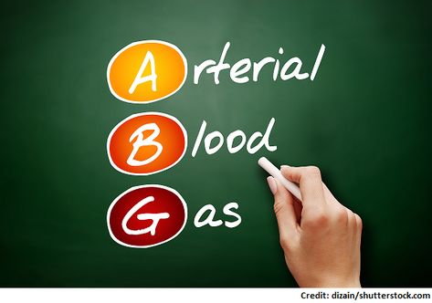 The ROME method can be used to interpret arterial blood gases (ABGs). This review is made for nursing students and can be used during lecture exams to help you determine respiratory/metabolic... Abg Interpretation, Arterial Blood Gases, Acidosis And Alkalosis, Respiratory Alkalosis, Nclex Practice Questions, Metabolic Alkalosis, Respiratory Acidosis, Metabolic Acidosis, Arterial Blood Gas