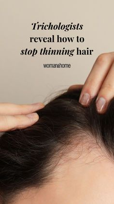 How To Stop Hair From Thinning, How To Stop Thinning Hair In Women, Female Hair Thinning, Curly Thinning Hair, Why Is My Hair Thinning, How To Stop Hair Thinning, Protective Hairstyles For Thinning Hair, Hair Thinning Remedies Woman, Hair Thinning At Crown