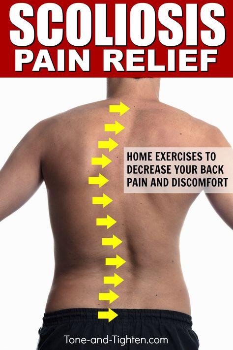 Best exercises to treat scoliosis at home! Physical therapy exercises to help treat your back pain. Inner Knee Pain, Spine Pain, Middle Back Pain, Back Stretches For Pain, Lower Back Pain Exercises, Physical Therapy Exercises, Lower Back Pain Relief, Nerve Pain Relief, Sciatic Nerve Pain