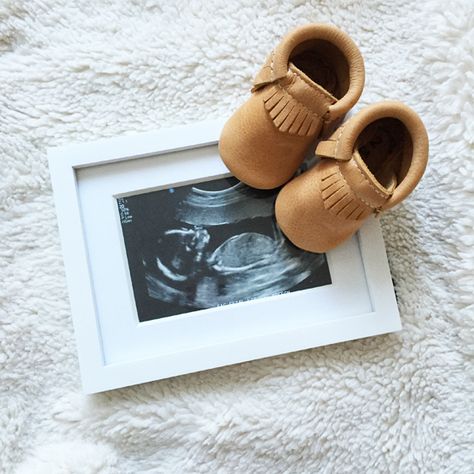 Baby Fotografie, Baby Sleep Problems, Foto Baby, Baby Moccasins, Reveal Ideas, Newborn Baby Photography, Baby Reveal, Trendy Baby, Baby Photoshoot