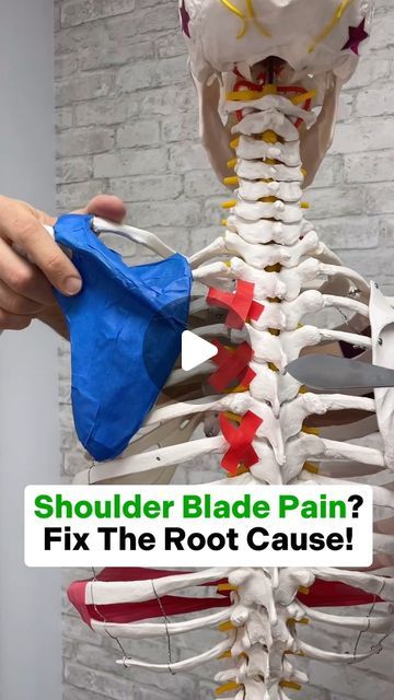 Dr. Joe Damiani - TMJ, Head & Neck Specialist on Instagram: "Do you experience shoulder blade pain that just won’t go away? Have you tried a bunch of different things that you found on the Internet? Well, if you don’t know why the pain is there and you’re just guessing it can take a very long time to figure out if ever. In this video, I explained the difference between pain generated from a myotome or the nerve that controls muscles versus a dermatome the nerve that controls sensation. In the area by the shoulder blade the nerve that controls sensation come from the upper back, whereas the nerves that control the muscle are from the neck so depending on what you experience, we have to treat a different area of the body in a different capacity to reduce the pain that’s located by the should How To Release Trapezius Muscle, Knots In Shoulder Blade, Pinched Nerve In Shoulder Blade, Knots In Neck Muscle, Shoulder Blade Pain Relief, Pinched Nerve In Shoulder, Nerves In Back, Shoulder Blade Stretch, Shoulder Blade Muscles