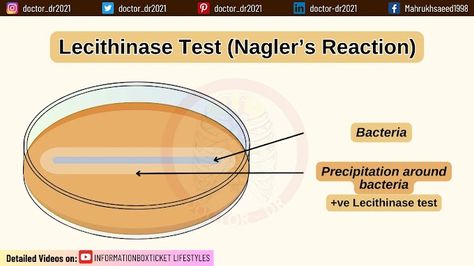 Lecithinase Test (Nagler’s Reaction): Principles, Procedures, and Interpretations - Biochemical Test for Microbiology By Microbiologist Doctor_dr2021 Microbiology, Science, Quick Saves