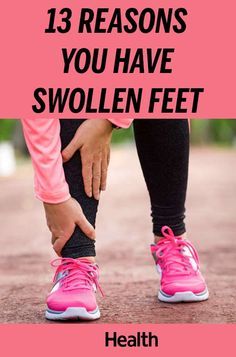 Whether the swelling is slight or your feet feel like balloons, something's off—and anything from changes in your weight to hormone weirdness to a serious condition like heart disease could be to blame. Our guide will help you decode what's going on, and what you can do to fit into your shoes again. Frankincense Oil Uses, Calendula Benefits, Zinc Deficiency, Swollen Ankles, Matcha Benefits, Coconut Health Benefits, Foot Health, Your Shoes, What You Can Do