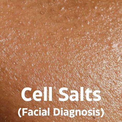 Lindsay- Consultant on Instagram: "I find it incredibly interesting that you can pinpoint cell salt deficiencies based on how your face/skin/mouth appear. It can take out the guess work of choosing the cell salt/salts that you need to get back into complete balance.  Many ask about taking the 12-in-1 (sometimes called bioplasma) and while this has a time and place, it isn't suggested for everyday use because the goal is to get all cell salts in balance. If you are very deficient in just a few and take the combination you are also supplementing the others that might already be close to healthy levels. I suggest the bioplasma in instances like breastfeeding, pregnancy, childhood, after an illness, or following a workout. Otherwise I suggest finding the few salts that are showing deficiency v Cell Salts, The Cell, Homeopathy, The Goal, A Workout, Face Skin, Take Out, Skin Cells, Get Back