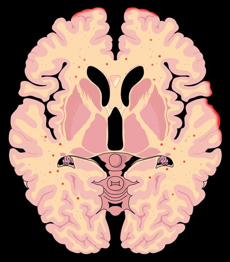 brain section Brain Sections, Brain Pictures, Igcse Art, Brain Images, Brain Structure, Art Project, Art Projects, Brain, Quick Saves