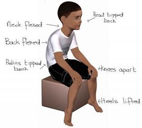 Posture exercise to counteract stereotypical "autistic" posture. Hypermobile Joints, Low Muscle Tone, Pediatric Physical Therapy, Pediatric Occupational Therapy, Posture Exercises, Ehlers Danlos Syndrome, Sensory Processing Disorder, Leg Muscles, Muscle Tone