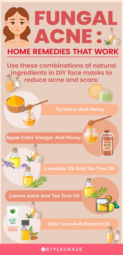 Back Acne Remedies, Blind Pimple, Fungal Acne, Turmeric And Honey, Acne Vulgaris, Diy Acne, Natural Acne Remedies, Natural Acne, Home Remedies For Acne