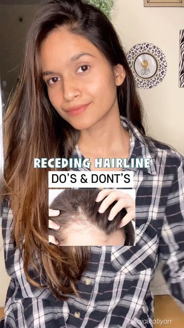 K A J A L on Instagram: "✨RECEDING HAIRLINE DO’S & DONT’S✨ Receding hairline is a very common disorder that can be caused by many different factors ! Common causes include aging, changes in hormone levels, heredity, medications, and medical conditions. You can’t completely stop 🛑 this but you can surely try these tips out to avoid receding hairline. Major Tips : Excess exposure to sunlight & sweating can be a major cause Ps. Incase of extreme receding hairline , seek a hair expert/doctor . Women Receding Hairline Hairstyles, Receding Hairline Women Hairstyles, Bangs For Receding Hairline Women, Hairstyles For Receding Hairline Women, Receding Hairline Women, Bob Haircut With Undercut, Fulani Braids On Natural Hair, Braids Without Extensions, Regrow Hairline