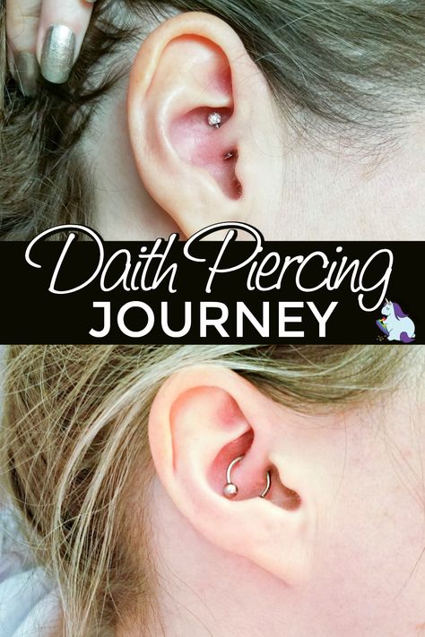 Daith Piercing Healing Process, Migraine Piercing Daith, Piercings For Migraines, Ear Piercing For Migraines, Piercing For Migraine Relief, Daith Piercing Healing, Daith Piercing Migraine, Migraine Piercing, Getting Rid Of Migraines