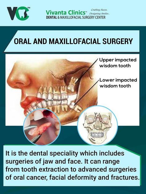 Surgical Assistant, Surgeon Humor, Impacted Wisdom Teeth, Orthognathic Surgery, Maxillofacial Surgery, Oral Maxillofacial, Dental Anatomy, Dentist Visit, Dental Tourism