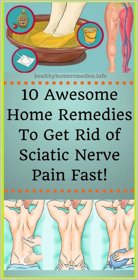 10 Awesome Home Remedies To Get Rid Of Sciatic Nerve Pain Nerve Pain Relief, Sciatic Nerve Pain, Sciatica Pain, Sciatic Nerve, Nerve Pain, Sciatica, Knee Pain, Health Remedies, Nerve