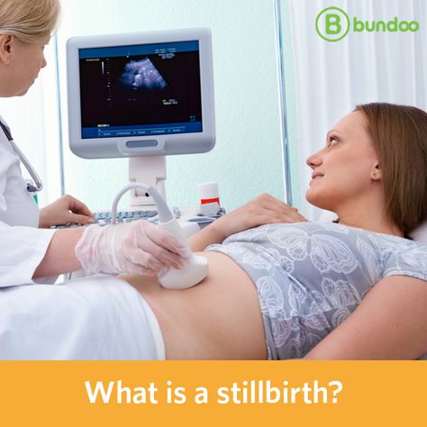 A stillbirth is the loss of a fetus after 20 weeks gestation. Learn more about potential risk factors. First Prenatal Visit, Baby Scan, Second Trimester, Salalah, Pregnancy Months, First Trimester, Pregnancy Symptoms, Baby Center, Madurai