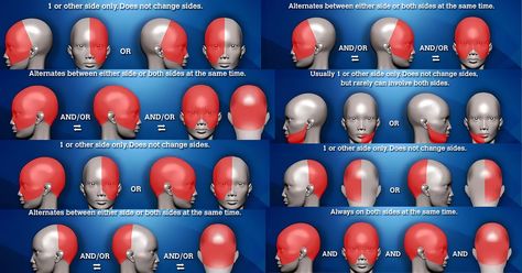 What is your location of headache meaning and what are headache placement meanings? Learn more from free headache charts, developed by a headache specialist. What Headaches Mean, Headache Map, Types Of Headaches Chart, Headache Location Meaning, Headache Meaning, Headache Location, Headache Chart, Complex Migraine, Headache Medicine