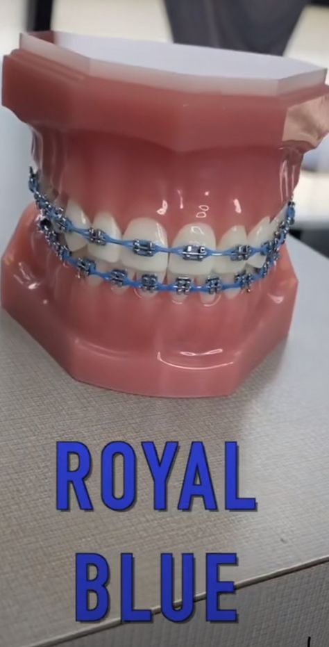 Dark Blue Braces, Power Chain Braces, Dental Braces Colors, Braces Colors Combinations, Pink Braces, Green Braces, Braces Colors Ideas, Jewelry Teeth, Braces And Glasses