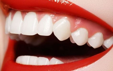 Zoom Teeth Whitening, Canine Teeth, Teeth Whitening Dentist, Teeth Remedies, Cosmetic Dentistry Procedures, Teeth Whitening Procedure, Canine Tooth, Discolored Teeth, Dental Facts