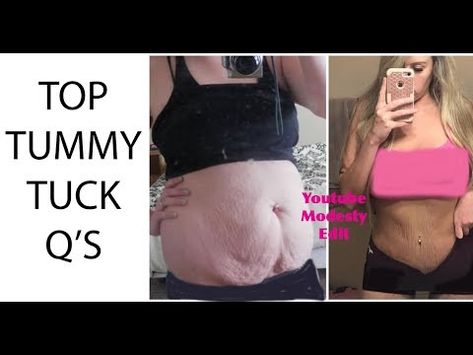 Over the last almost 6 years. I get LOTS of questionson a tummy tuck and the healing. So I wanted to do an updated Q&A of my top ask TT ... Tummy Tucks Recovery, Skin Removal Surgery, Mommy Makeover Surgery, Glass Noodles, Mommy Makeover, Breast Surgery, Surgery Recovery, Noodles Recipe, Compression Garment