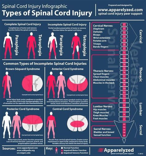 Pt School, Spinal Cord Injuries, Physical Therapist Assistant, Physical Therapy Assistant, Pta School, Pa School, Spinal Injury, Medicine Student, Nursing Tips