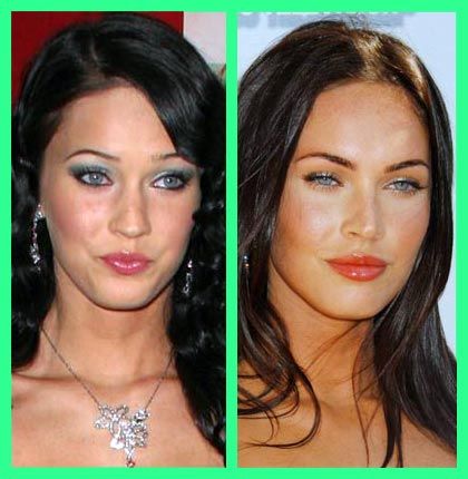 Megan Fox Before and After | Plastic Surgery Before And After Celebrity Surgery, Plastic Surgery Fail, Plastic Surgery Photos, Plastic Surgery Gone Wrong, Cheek Fillers, Plastic Surgery Procedures, Before After, Celebrity Plastic Surgery, Celebrities Before And After