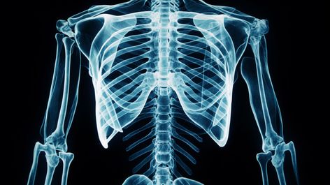 picture of a chest x-ray,chest,x-ray,hospital,medical,skeleton,health,bone,human,ray,medicine,healthcare,radiology,doctor,xray,body,radiography,diagnosis,picture,x Brain X Ray, Radiology Doctor, X Ray Skeleton, Medical Skeleton, Chest X Ray, Ray Background, X-ray Images, Human Bones, Fall Music