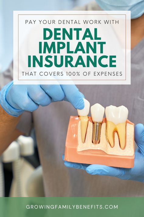 Missing teeth can knock your confidence, but dental implants offer a solid solution. Learn about options for missing teeth and how dental implants cost doesn't have to be a barrier. From insurance coverages to programs offering free dental implants, this guide walks you through how to get free dental implants and affordable solutions. Say goodbye to the gaps in your smile with confidence. Read the article for more. Missing Teeth Solutions, All On Four Implants, Dental Implants Advertising, Full Mouth Dental Implants, Free Dental Implants, Benefits Of Dental Implants, Affordable Dental Implants, Dental Work, Pinterest Tutorials