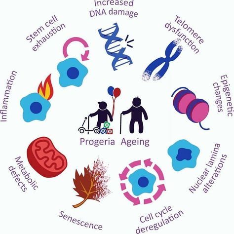 👫 The similarity between progeria and elderly. 👫   Progeria is a rare autosomal dominant genetic disorder. Those born with progeria typically live to their mid-teens to early twenties. It is a genetic condition that occurs as a new mutation, and is rarely inherited, as carriers usually do not live to reproduce children.    Comment if you know someone with progeria!   Follow @discovergenetics for more updates! Cell Cycle, Dna Repair, Genetic Disorders, Science Facts, Stem Cells, Genetic, Mice, Disease, Portal