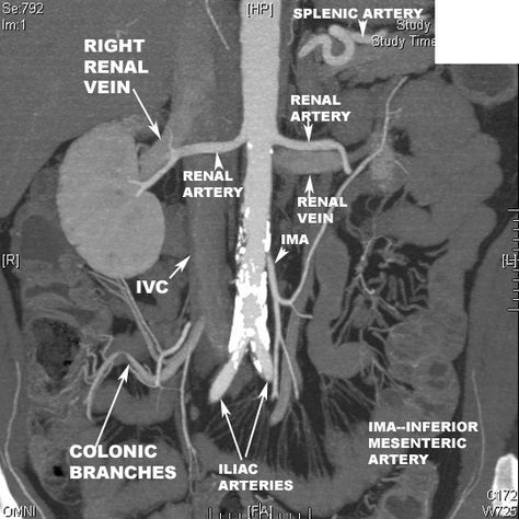 Mri Study Guide, Image Production Radiology, Digital Radiography, Arteries Anatomy, Radiology Schools, Medical School Interview, Vascular System, Medical Radiography, Doctor Quotes Medical