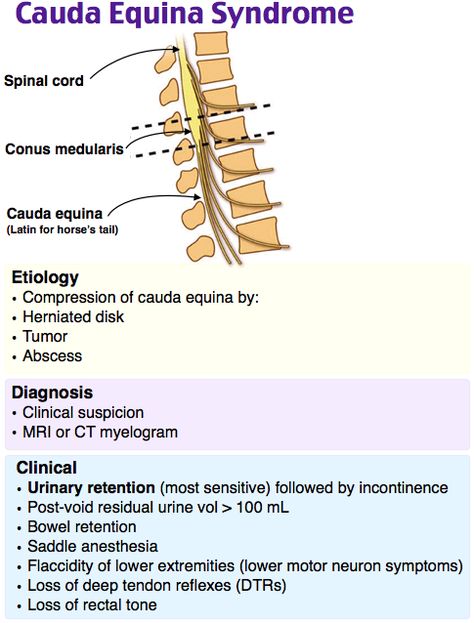 Cauda Equina Syndrome Medicine Facts, Medical Diagrams, Physician Assistant School, Cauda Equina, Physical Therapy School, Med Surg Nursing, Gross Anatomy, Nursing Mnemonics, Emergency Nursing