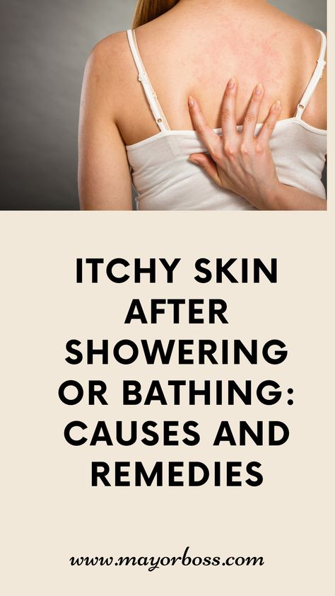 See the common causes of itchy skin after showering or bathing, and find effective remedies to alleviate the discomfort. From dry skin to allergies, learn about the triggers and solutions to restore your skin's comfort. Itching Skin Remedies, Dry Itchy Skin Remedies, Itching Remedies, Itchy Body, Itchy Skin Remedy, Remedies For Dry Mouth, Home Remedies For Warts, Oily Skin Remedy, Warts Remedy