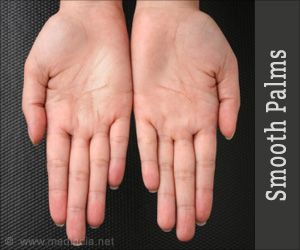 Smoothen Those Rough Palms How To Soften Hands, Hand Scrub Diy, Natural Nail Shapes, Home Remedies For Wrinkles, Coffee Face Mask, Rough Hands, Hand Palm, Hand Scrub, Summer Glow