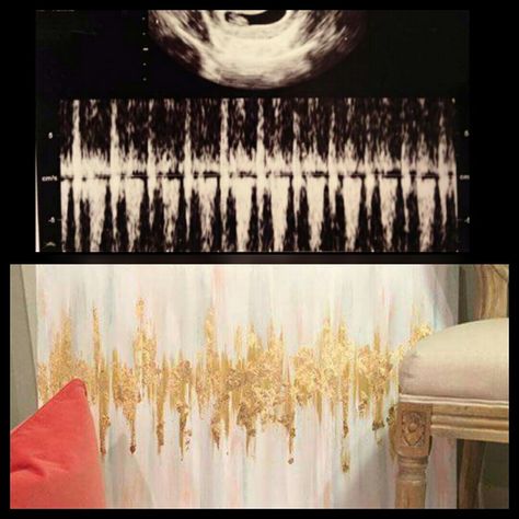 get your unborn baby's sonogram heartbeat rate made into art. I love this idea! Heartbeat Painting, Baby Heart Beat, Sonogram Paintings, Miscarriages Pictures Art, Baby Heartbeat Ultrasound Video, Baby Sonogram, Baby Heartbeat, Unborn Baby, Gold Rate