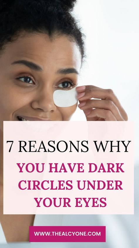 Eye Circle Remedies, Dark Circles Makeup, Dark Circle Remedies, Dark Circles Around Eyes, Hide Dark Circles, Dark Eye Circles, Covering Dark Circles, Eye Cream For Dark Circles, Under Eye Puffiness