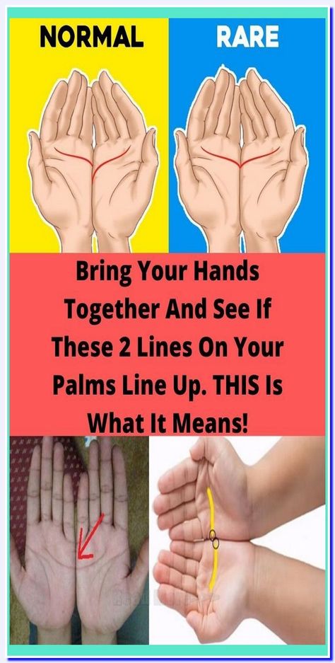 BRING YOUR HANDS TOGETHER AND SEE IF THESE 2 LINES ON YOUR PALMS LINE UP. THIS IS WHAT IT MEANS! Palm Lines Meaning, Palm Lines, Too Much Estrogen, Palm Reader, Hands Together, Fitness Articles, Health Promotion, Health Info, Health Advice