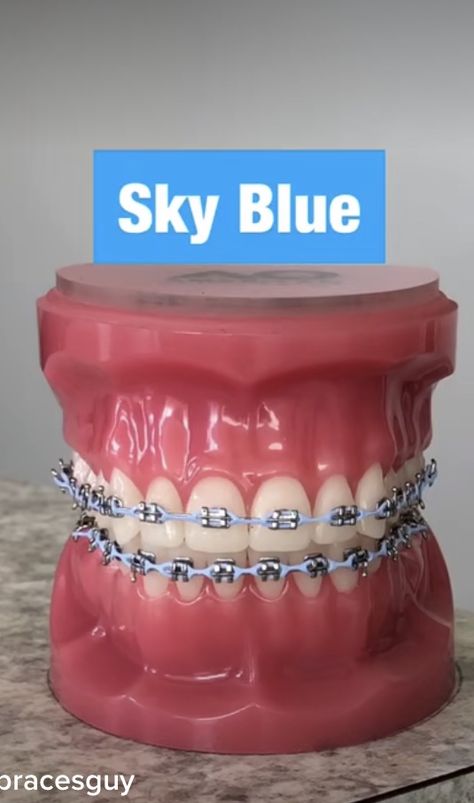 Braces Sky Blue, Baby Blue Braces, Good Braces Colors, Sky Blue Braces, Pretty Braces Colors, Braces Colors Aesthetic, Navy Blue Braces, Light Blue Braces, Brace Colors