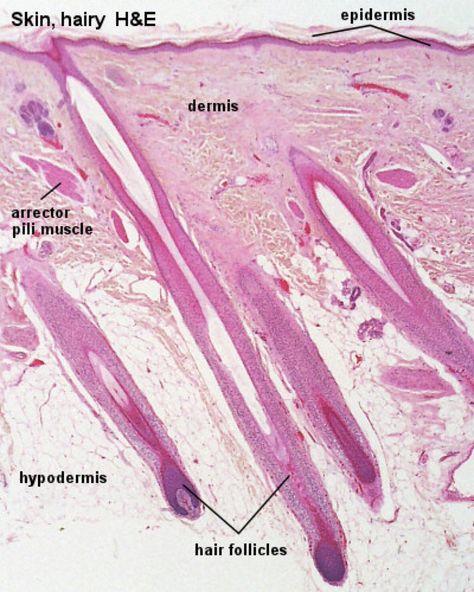 Skin with Hair Follicles - Histology Apologia Biology, Histology Slides, Basement Membrane, Skin Anatomy, Integumentary System, Microscopic Photography, Vet Medicine, Basic Anatomy And Physiology, Nurse Study Notes