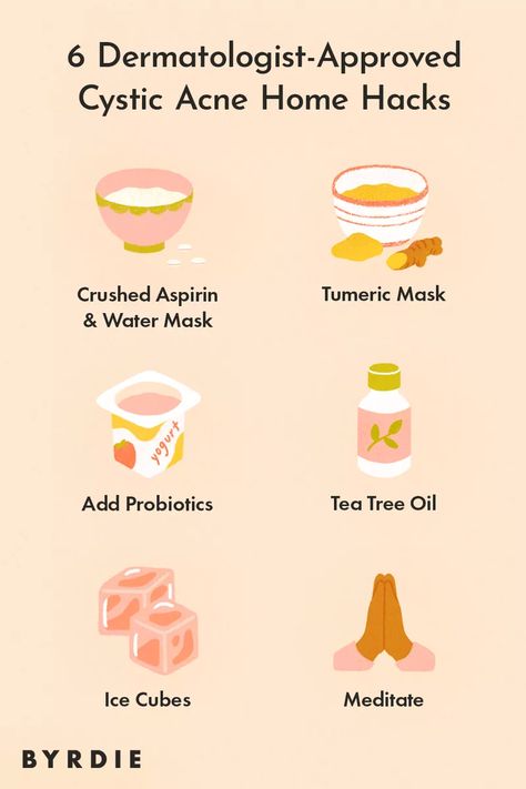 How to Get Rid of Cystic Acne According to Skin Experts Get Rid Of Cystic Acne, Treating Cystic Acne, Cystic Acne Remedies, Cystic Pimple, Forehead Acne, Natural Acne Remedies, Natural Acne, Home Remedies For Acne, How To Get Rid Of Pimples