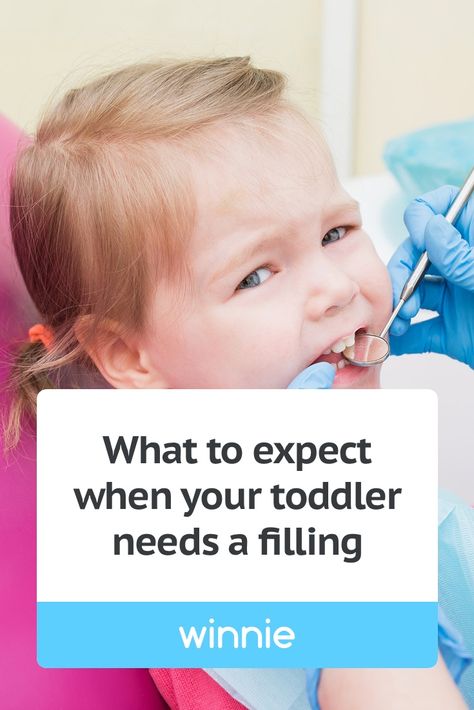 "They told me that my little one cried for me a bit after being taken to the back but it wasn’t too bad...When it was all done the dentist came out carrying him and he was perfectly fine! He actually wanted to stay there longer!" #dentist #cavities #toddlers #dentalhealth Toddler Cavities, Cavity Filling, Parenting Resources, The Dentist, Parent Resources, Dental Health, Healthy Kids, Cavities, Coming Out