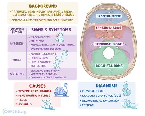 Basilar Skull Fracture: What Is It, Causes, Symptoms, and More | Osmosis Osteoporosis Nursing, Sphenoid Bone, Glasgow Coma Scale, Raccoon Eyes, Hospital Medicine, Medical Pins, Loss Of Balance, Nurse Study Notes, Hospice Nurse