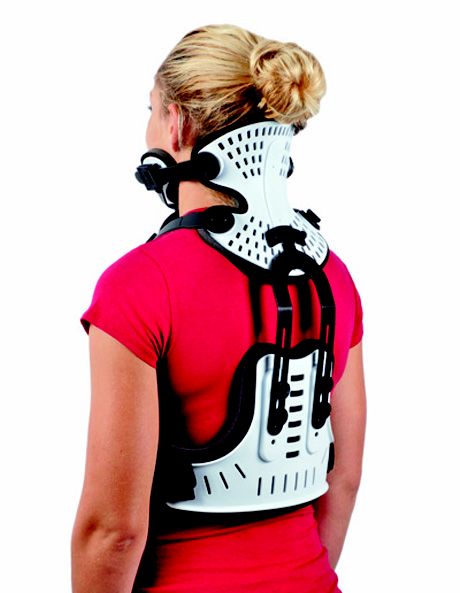 The symptoms are similar to ankylosing spondylitis and osteoarthritis of the spine including warmth and swelling in the joints. Halo Brace, Cauda Equina, Orthopedic Brace, Cervical Pain, Spinal Surgery, Shoulder Brace, Brace Face, Back Brace, Hand Therapy