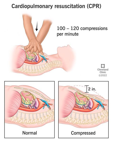 How To Do Cpr, How To Perform Cpr, Cardiopulmonary Resuscitation, Baby Shark Song, Cpr Training, Health Psychology, Training Academy, Cleveland Clinic, Two Fingers