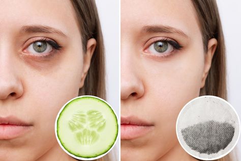 At-home remedies to fix under-eye bags, as recommended by ophthalmologists Eye Bag Remedies, Health Websites, Bags Under Eyes, Fluid Retention, Under Eyes, Regenerative Medicine, Work Schedule, Under Eye Bags, Eye Bags